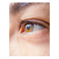 Laser eye surgery