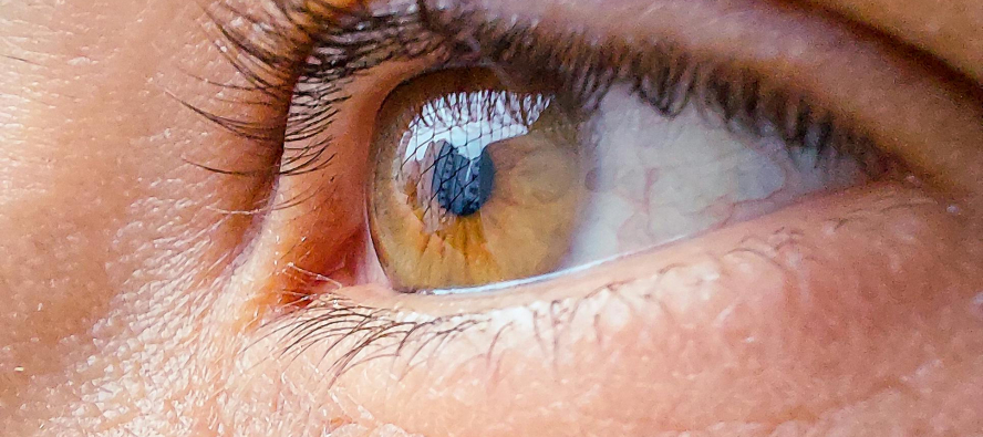 Laser eye surgery