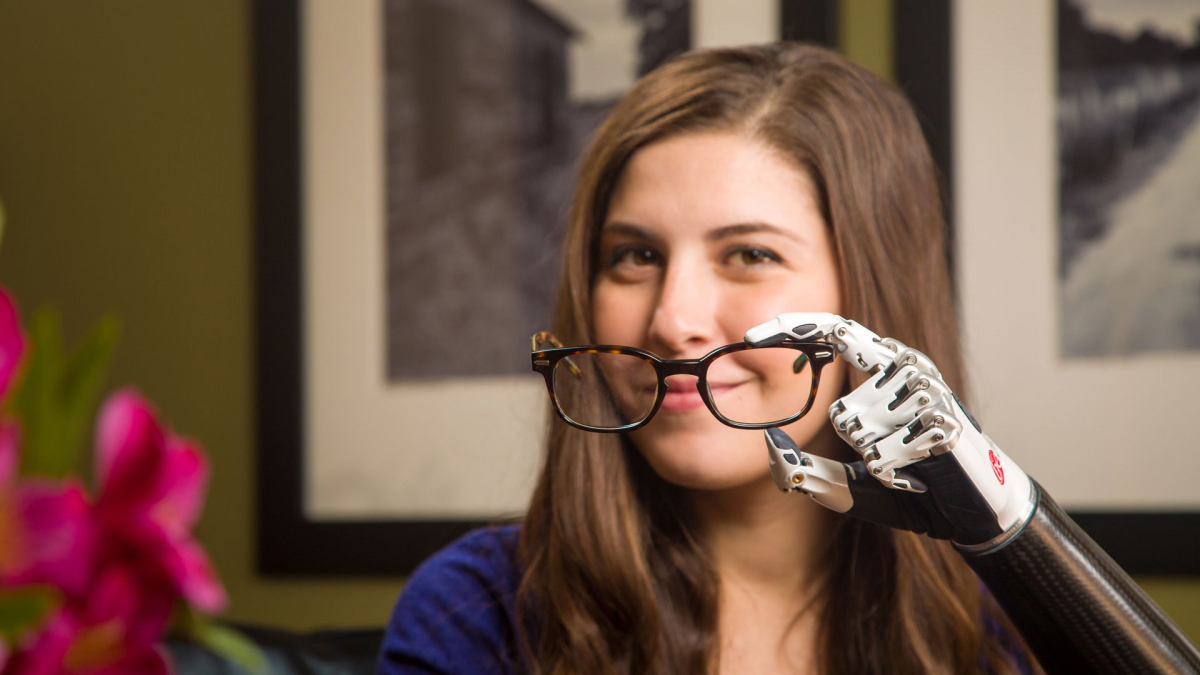 Steeper BeBionic Prosthetic Hand